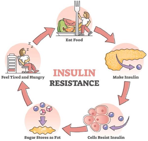 Unveiling Insulin Resistance: Causes, Symptoms, Diagnosis & Prevention